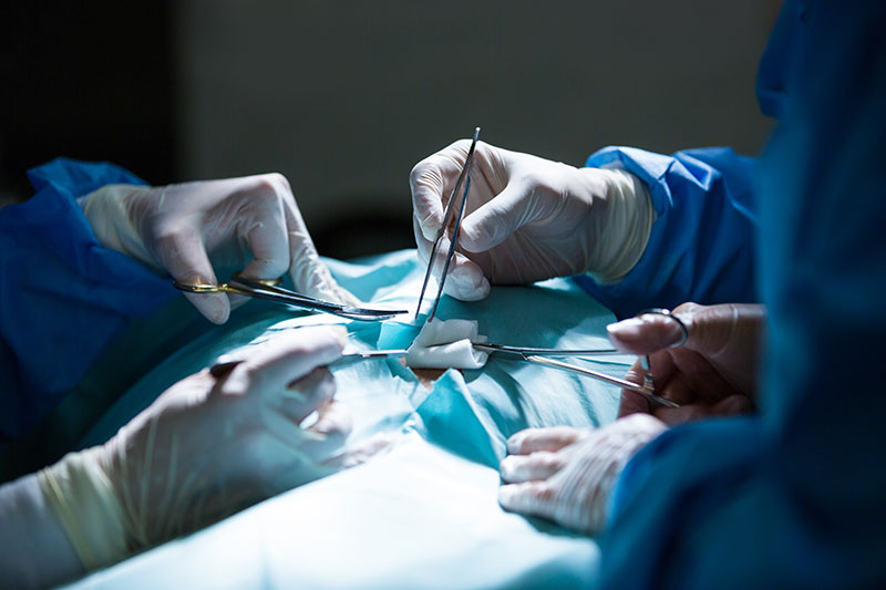 laparoscopy